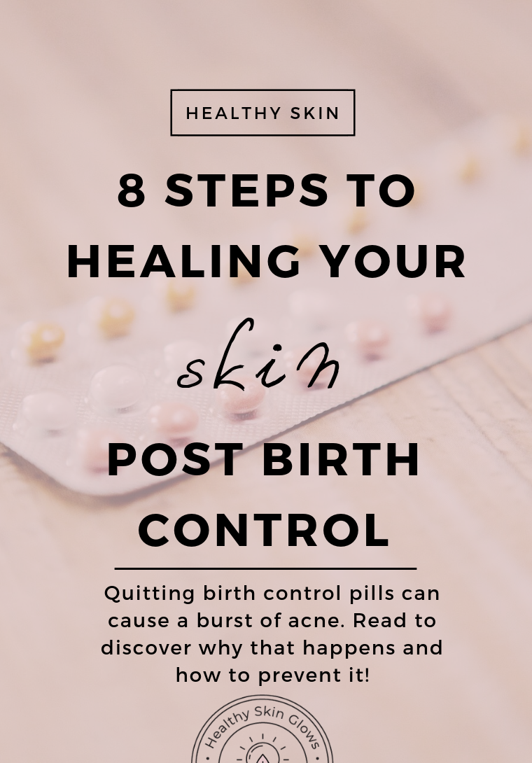 Healing acne post birth control pills