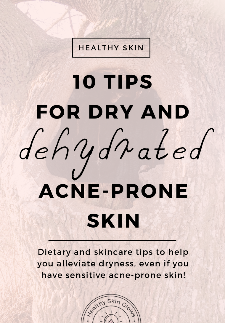 dry acne-prone skin