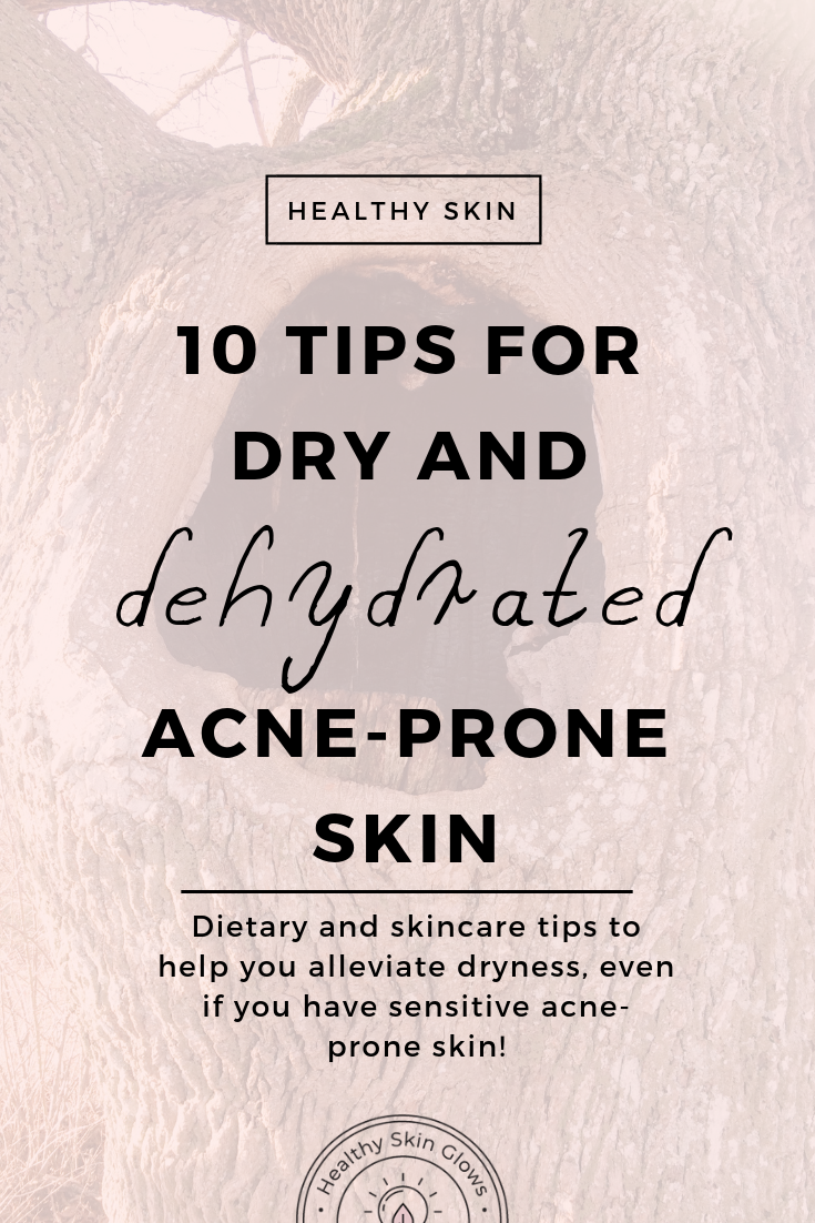 Top 10 Tips For Dry Acne Prone Skin