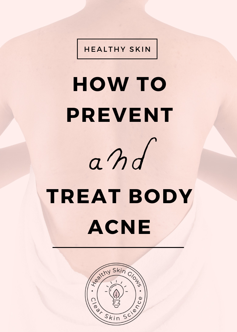 prevent and treat body acne